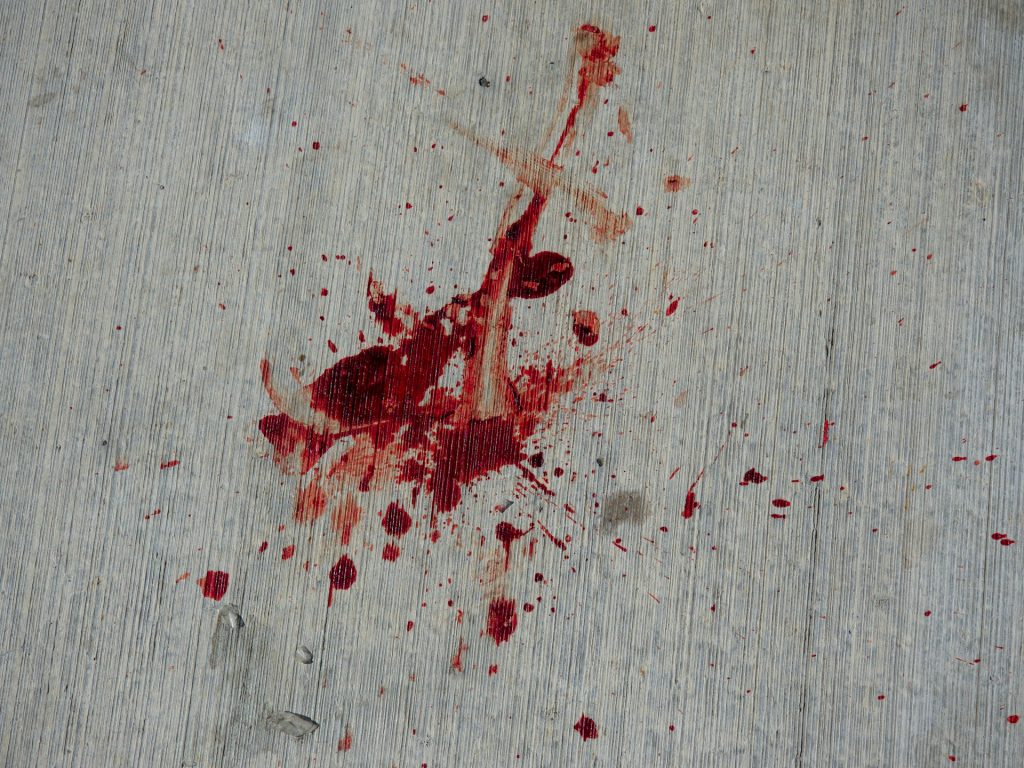 Teen Stabbed In UK Days After Violent Belfast Attack