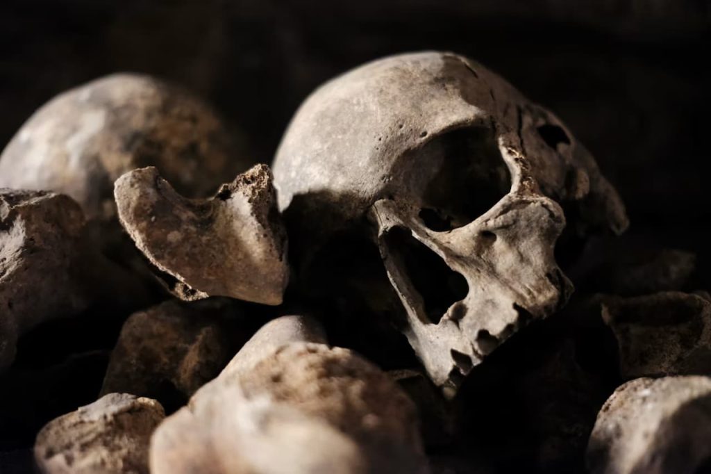 Sick Belfast Auction Under Fire for Selling Human Remains